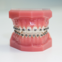 Brackets ROTH MBT O-Ice